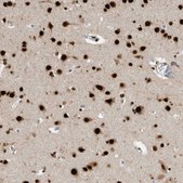 Anti-BCLAF1 antibody produced in rabbit Prestige Antibodies® Powered by Atlas Antibodies, affinity isolated antibody, buffered aqueous glycerol solution