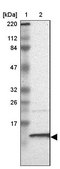 Anti-RPA3 antibody produced in rabbit Prestige Antibodies® Powered by Atlas Antibodies, affinity isolated antibody, buffered aqueous glycerol solution
