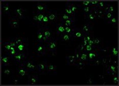 Anti-IRAK2 (ab2) antibody produced in rabbit affinity isolated antibody, buffered aqueous solution