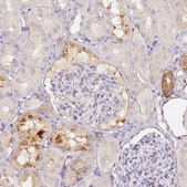 Anti-CFHR1 antibody produced in rabbit Prestige Antibodies® Powered by Atlas Antibodies, affinity isolated antibody, buffered aqueous glycerol solution
