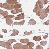 Anti-KLHL40 antibody produced in rabbit Prestige Antibodies® Powered by Atlas Antibodies, affinity isolated antibody, buffered aqueous glycerol solution