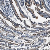 Anti-OGDH antibody produced in rabbit Prestige Antibodies® Powered by Atlas Antibodies, affinity isolated antibody, buffered aqueous glycerol solution