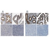 Anti-PGR antibody produced in rabbit Ab1, Prestige Antibodies® Powered by Atlas Antibodies, affinity isolated antibody, buffered aqueous glycerol solution