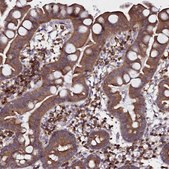 Anti-NCKAP1L antibody produced in rabbit Prestige Antibodies® Powered by Atlas Antibodies, affinity isolated antibody, buffered aqueous glycerol solution