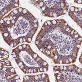 Anti-IDH3A antibody produced in rabbit affinity isolated antibody, buffered aqueous glycerol solution