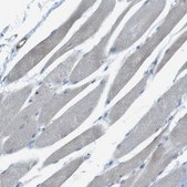 Anti-YIF1A antibody produced in rabbit Prestige Antibodies® Powered by Atlas Antibodies, affinity isolated antibody, buffered aqueous glycerol solution