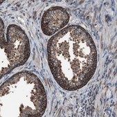Anti-USP10 antibody produced in rabbit Ab1, Prestige Antibodies® Powered by Atlas Antibodies, affinity isolated antibody, buffered aqueous glycerol solution