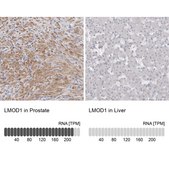 Anti-LMOD1 antibody produced in rabbit Prestige Antibodies® Powered by Atlas Antibodies, affinity isolated antibody, buffered aqueous glycerol solution, ab2