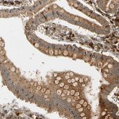 Anti-MRPS22 antibody produced in rabbit Prestige Antibodies® Powered by Atlas Antibodies, affinity isolated antibody, buffered aqueous glycerol solution, Ab2