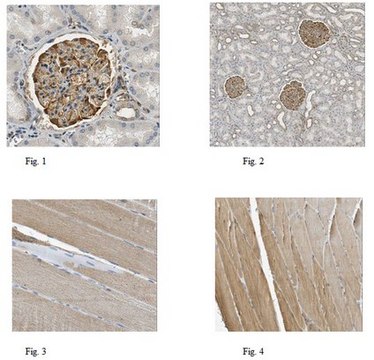 Anti-Parvin alpha Antibody, clone 7E2.1 clone 7E2.1, from mouse