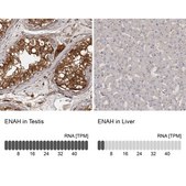 Anti-ENAH antibody produced in rabbit Prestige Antibodies® Powered by Atlas Antibodies, affinity isolated antibody, buffered aqueous glycerol solution, ab1