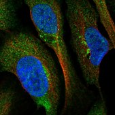 Anti-BROX antibody produced in rabbit Prestige Antibodies® Powered by Atlas Antibodies, affinity isolated antibody, buffered aqueous glycerol solution