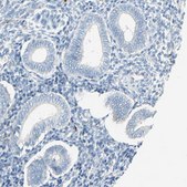 Anti-PPBP antibody produced in rabbit Prestige Antibodies® Powered by Atlas Antibodies, affinity isolated antibody, buffered aqueous glycerol solution