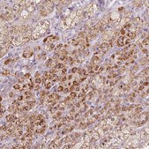 Anti-CYP11B2 antibody produced in rabbit Prestige Antibodies® Powered by Atlas Antibodies, affinity isolated antibody, buffered aqueous glycerol solution