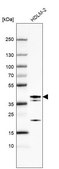 Anti-ETV7 antibody produced in rabbit Prestige Antibodies® Powered by Atlas Antibodies, affinity isolated antibody, buffered aqueous glycerol solution