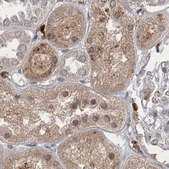 Anti-NAGK antibody produced in rabbit Prestige Antibodies® Powered by Atlas Antibodies, affinity isolated antibody, buffered aqueous glycerol solution