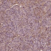 Anti-SAT2 antibody produced in rabbit Prestige Antibodies® Powered by Atlas Antibodies, affinity isolated antibody, buffered aqueous glycerol solution