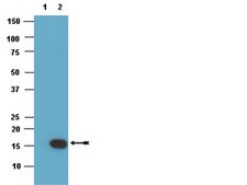 ChIPAb+ Phospho-Histone H3 (Ser10) - ChIP Validated Antibody and Primer Set clone CMA312, from mouse, purified by using protein G