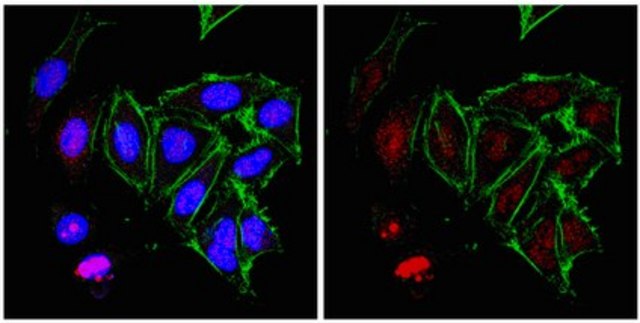 Anti-RNA polymerase II subunit B1 Antibody, clone 4F8 from rabbit, purified by affinity chromatography