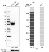 Anti-VIM antibody produced in rabbit Prestige Antibodies® Powered by Atlas Antibodies, affinity isolated antibody, buffered aqueous glycerol solution