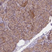 Anti-AK3 antibody produced in rabbit Prestige Antibodies® Powered by Atlas Antibodies, affinity isolated antibody, buffered aqueous glycerol solution
