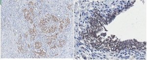 Anti-Lipoprotein Lipase Antibody, clone 5D2 clone 5D2, from mouse