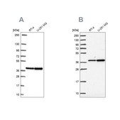 Anti-RFC4 antibody produced in rabbit Prestige Antibodies® Powered by Atlas Antibodies, affinity isolated antibody, buffered aqueous glycerol solution