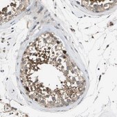 Anti-SLC25A20 antibody produced in rabbit Prestige Antibodies® Powered by Atlas Antibodies, affinity isolated antibody, buffered aqueous glycerol solution