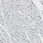 Anti-PTGDS antibody produced in rabbit Prestige Antibodies® Powered by Atlas Antibodies, affinity isolated antibody, buffered aqueous glycerol solution