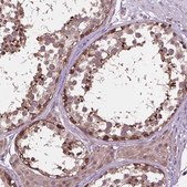 Anti-NUDT1 antibody produced in rabbit Prestige Antibodies® Powered by Atlas Antibodies, affinity isolated antibody, buffered aqueous glycerol solution