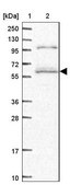 Anti-SMG9 antibody produced in rabbit Prestige Antibodies® Powered by Atlas Antibodies, affinity isolated antibody, buffered aqueous glycerol solution