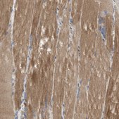 Anti-PPM1B antibody produced in rabbit Prestige Antibodies® Powered by Atlas Antibodies, affinity isolated antibody, buffered aqueous glycerol solution