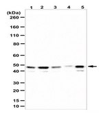 Anti-ADE2 Antibody/SAICAR synthetase from rabbit, purified by affinity chromatography