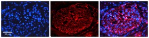Anti-PTCH1 antibody produced in rabbit affinity isolated antibody