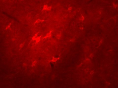 Anti-p67-phox (mouse) Antibody Upstate&#174;, from rabbit