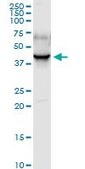 Anti-PDLIM1 antibody produced in rabbit purified immunoglobulin, buffered aqueous solution