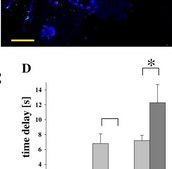 Anticuerpo anti-actina, αmúsculo liso- Cy3™ monoclonal de ratón clone 1A4, purified from hybridoma cell culture