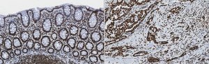 Anti-trimethyl-Histone H3 (Lys4) Antibody, clone MC315, rabbit monoclonal culture supernatant, clone MC315, Upstate®