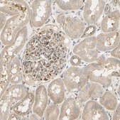 Anti-IKBKG antibody produced in rabbit Prestige Antibodies® Powered by Atlas Antibodies, affinity isolated antibody, buffered aqueous glycerol solution