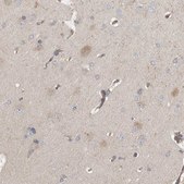 Anti-C9orf72 antibody produced in rabbit Prestige Antibodies® Powered by Atlas Antibodies, affinity isolated antibody, buffered aqueous glycerol solution