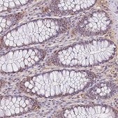 Anti-ALDH1A3 antibody produced in rabbit Prestige Antibodies® Powered by Atlas Antibodies, affinity isolated antibody, buffered aqueous glycerol solution