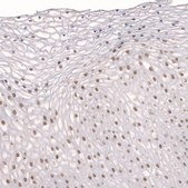 Anti-TET3 antibody produced in rabbit Prestige Antibodies® Powered by Atlas Antibodies, affinity isolated antibody, buffered aqueous glycerol solution