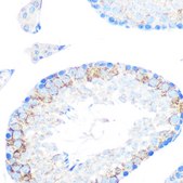 Anti-MSR1 Antibody, clone 10O8B0, Rabbit Monoclonal