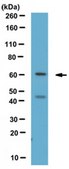 Anti-LGI1 Antibody from rabbit