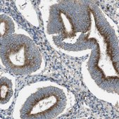 Anti-LAMP1 antibody produced in rabbit Prestige Antibodies® Powered by Atlas Antibodies, affinity isolated antibody, buffered aqueous glycerol solution