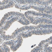 Anti-CDH6 antibody produced in rabbit Ab2, Prestige Antibodies® Powered by Atlas Antibodies, affinity isolated antibody, buffered aqueous glycerol solution