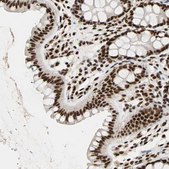 Anti-ILF2 antibody produced in rabbit Prestige Antibodies® Powered by Atlas Antibodies, affinity isolated antibody, buffered aqueous glycerol solution