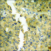 Anti-phospho-PYK2 (pTyr881) antibody produced in rabbit affinity isolated antibody