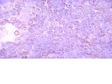 Anti-Casein Kinase 2α Antibody, 1AD9 clone 1AD9, from mouse