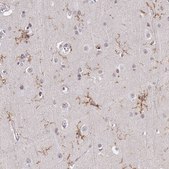Anti-TMEM119 antibody produced in rabbit Prestige Antibodies® Powered by Atlas Antibodies, affinity isolated antibody, buffered aqueous glycerol solution